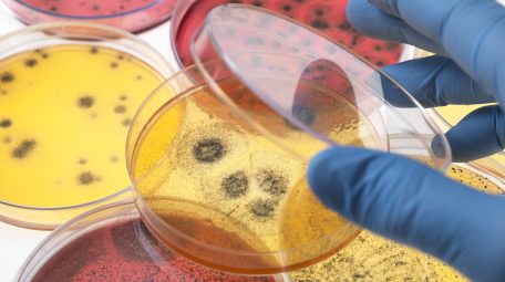 Scientist examining petri dishes containing bacterial growth in the laboratory