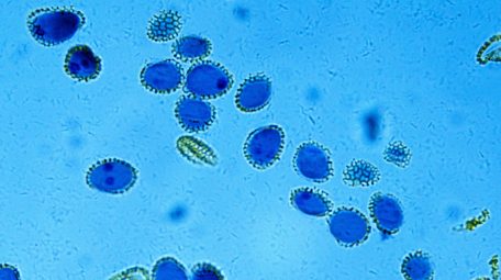 Lillium anther under Optical Microscope